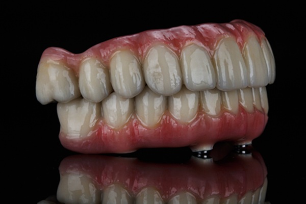 How All On   Is A Recommended Solution For Tooth Loss