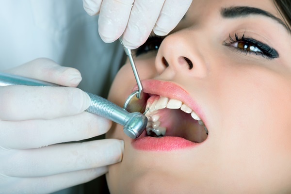 What To Know About Dental Filling Material Options